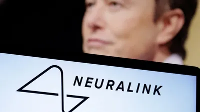elon musk s neuralink gains approval for human brain implant trial