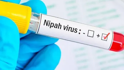 nipah virus  india to source 20 more doses of monoclonal antibody from australia for treatment